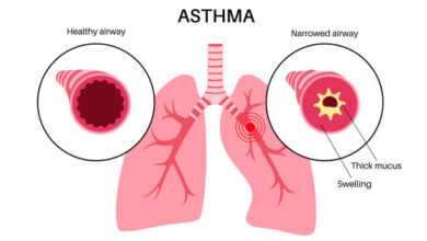 Asthma Bronchitis Breathing Beyond Limits