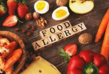 Food Allergy Recognizing and Responding to Symptoms